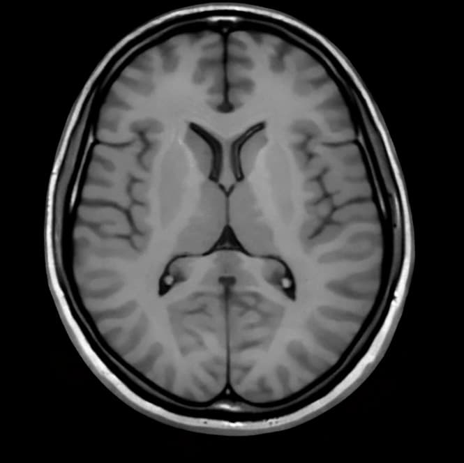 Image Enhancement Workflows